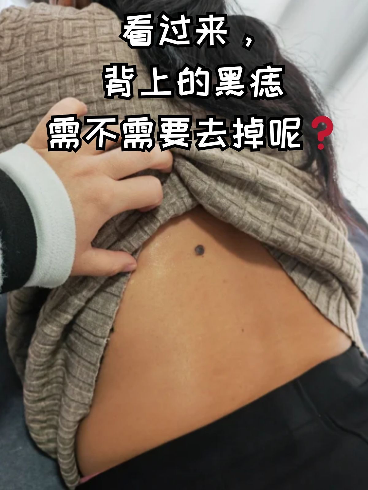 女人右手背有5颗痣图解(女人右手背有5颗痣图解视频) 女人右手背有5颗痣图解(女人右手背有5颗痣图解视频)