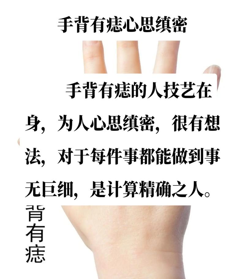 女人右手背有5颗痣图解(女人右手背有5颗痣图解视频) 女人右手背有5颗痣图解(女人右手背有5颗痣图解视频)