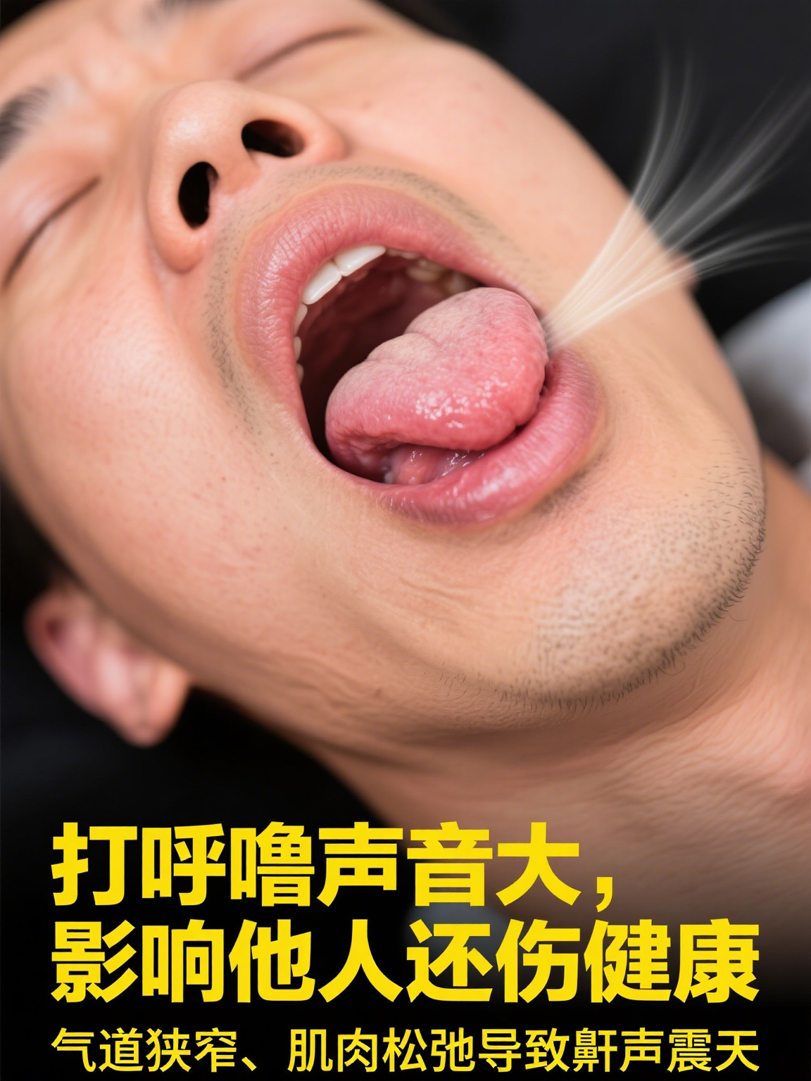 打鼾的声音特别大怎么治疗(打鼾的声音特别大怎么治疗,应该吃什么药才能治疗呼噜) 打鼾的声音特别大怎么治疗(打鼾的声音特别大怎么治疗,应该吃什么药才能治疗呼噜)