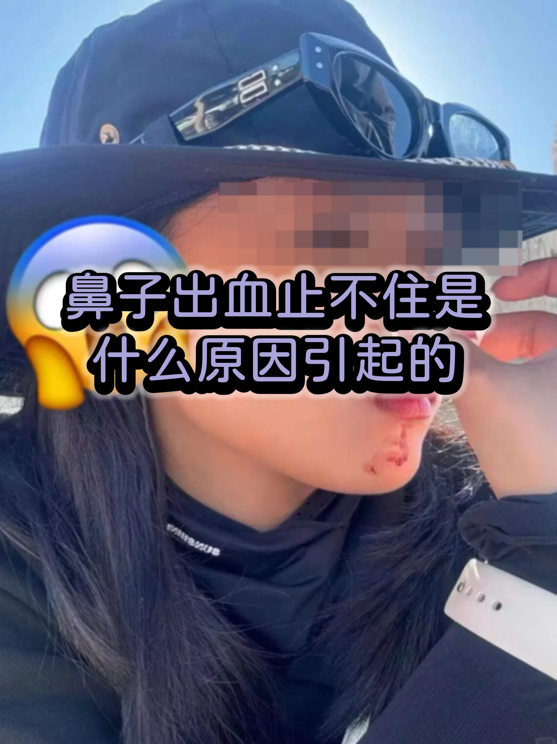 猫咪流鼻血是什么原因(猫咪流鼻血是什么原因引起的) 猫咪流鼻血是什么原因(猫咪流鼻血是什么原因引起的)