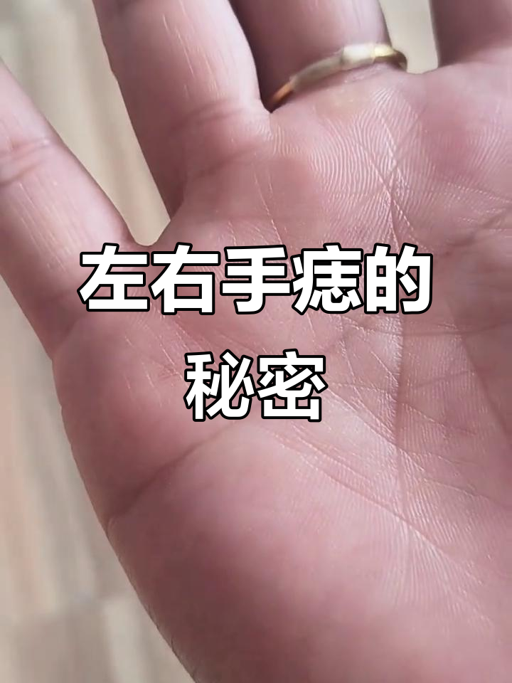 女人左手小拇指有痣全图解(女孩左手小拇指有痣代表什么意思) 女人左手小拇指有痣全图解(女孩左手小拇指有痣代表什么意思)