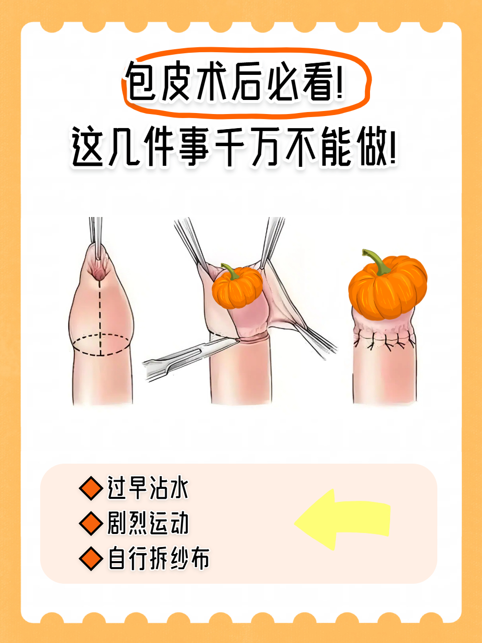 一定要割礼吗(割礼还在继续吗) 一定要割礼吗(割礼还在继续吗)