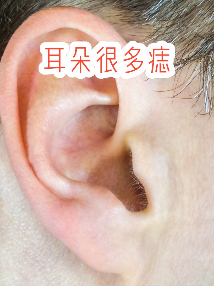 右耳垂有痣的男人(右耳垂有痣的男人旺妻) 右耳垂有痣的男人(右耳垂有痣的男人旺妻)