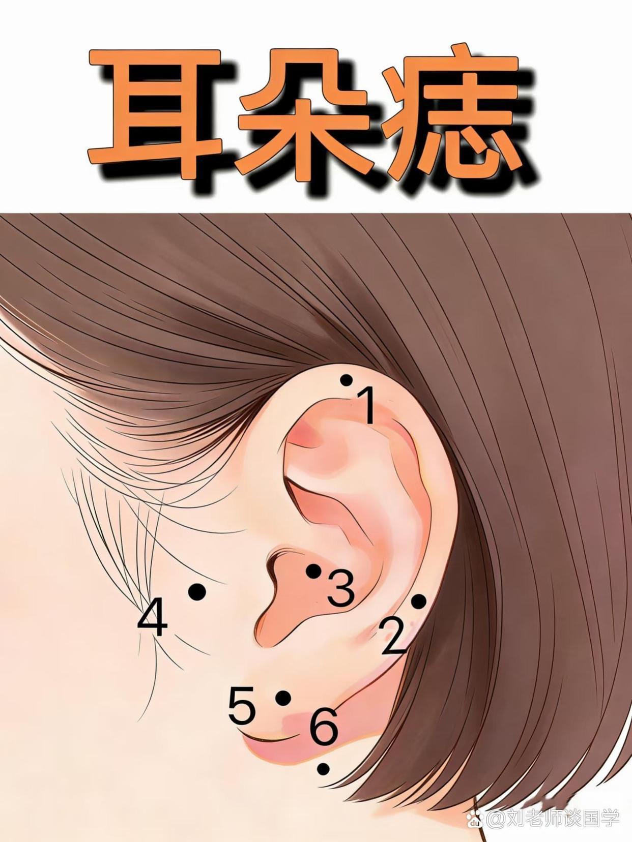 右耳垂有痣的男人(右耳垂有痣的男人旺妻) 右耳垂有痣的男人(右耳垂有痣的男人旺妻)