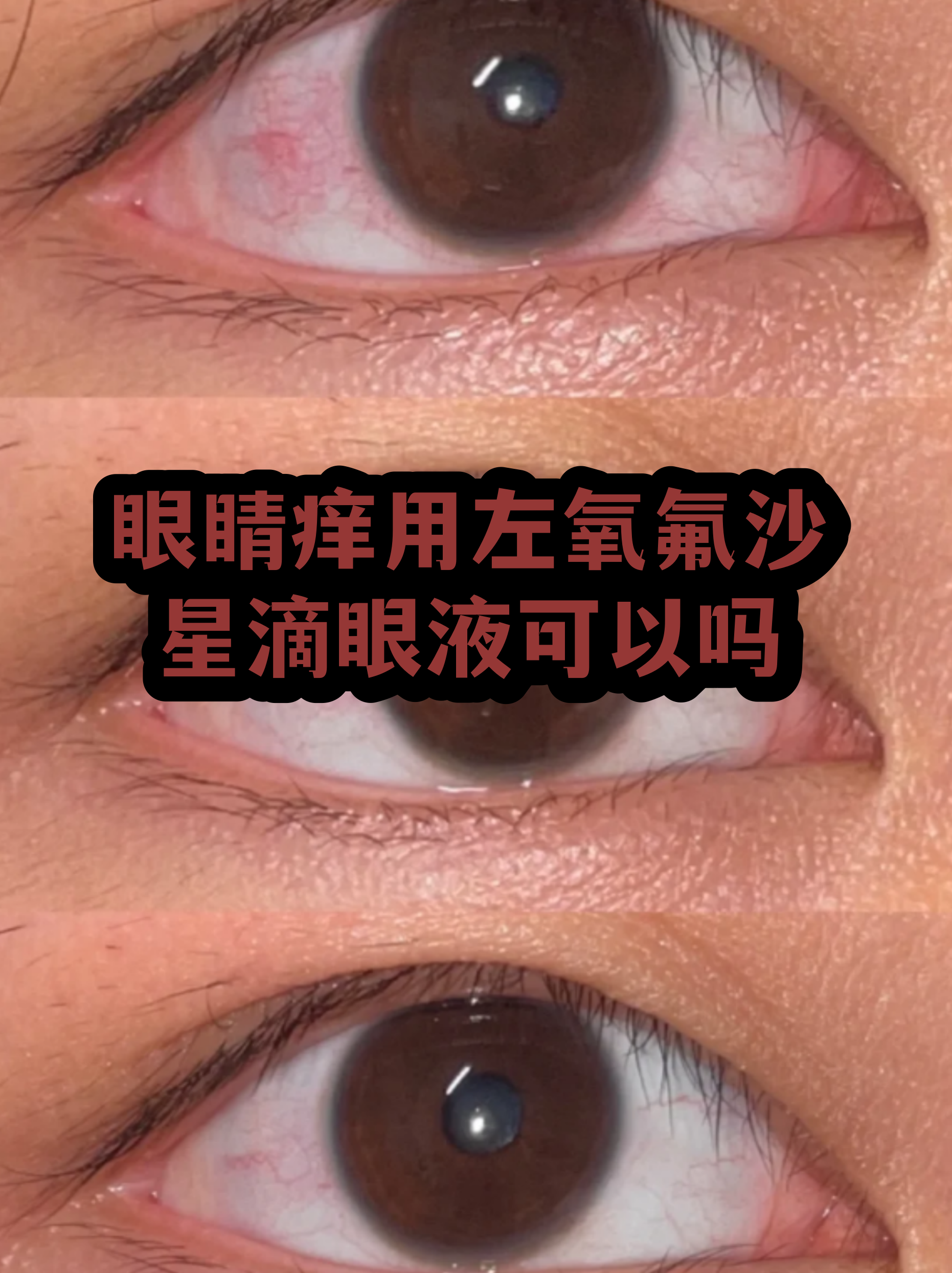 猫咪可以用氧氟沙星滴眼液吗(猫眼睛流脓一样的眼屎用什么药)