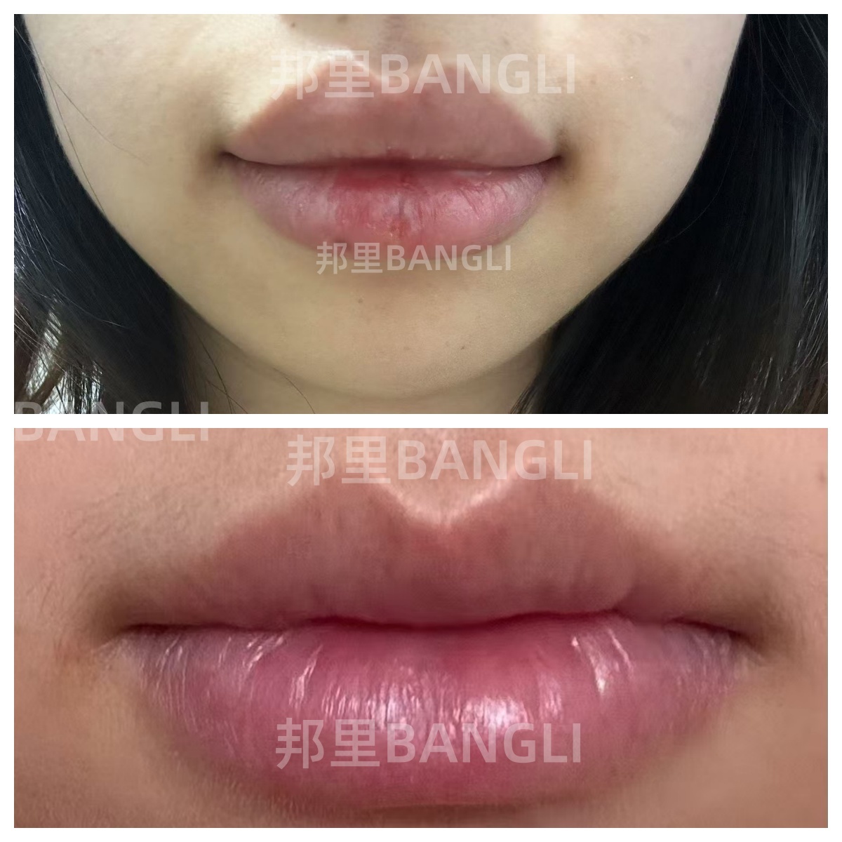 女人上嘴唇薄下嘴唇厚代表什么(女人上嘴唇薄下嘴唇厚代表什么命运) 女人上嘴唇薄下嘴唇厚代表什么(女人上嘴唇薄下嘴唇厚代表什么命运)