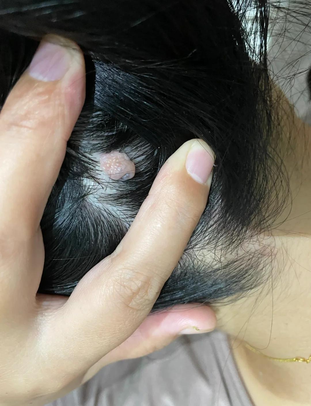 耳垂后面长痣(耳垂后面长痣好不好) 耳垂后面长痣(耳垂后面长痣好不好)