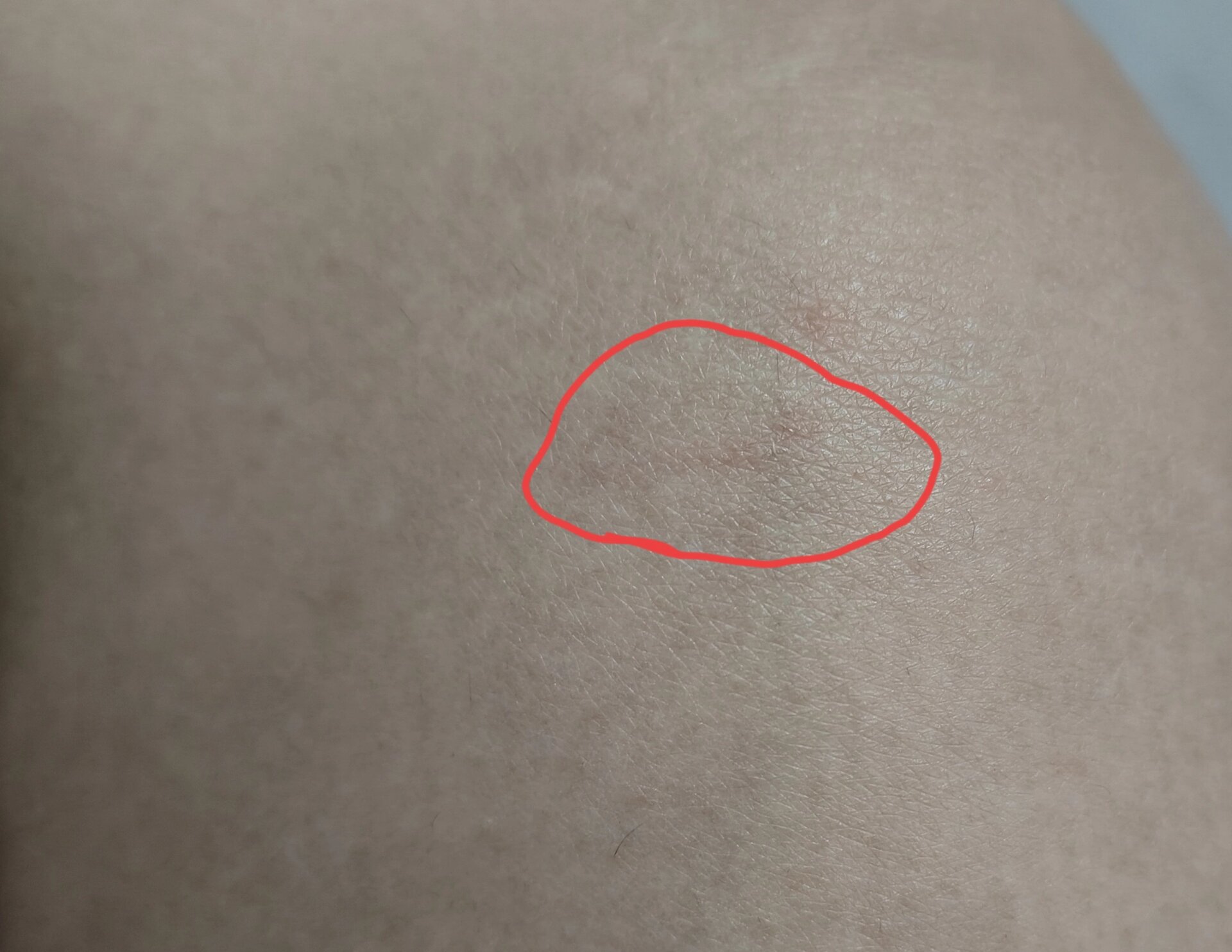 狗狗爪子划破轻微出血(狗狗爪子划破轻微出血狗狗打过疫苗) 狗狗爪子划破轻微出血(狗狗爪子划破轻微出血狗狗打过疫苗)