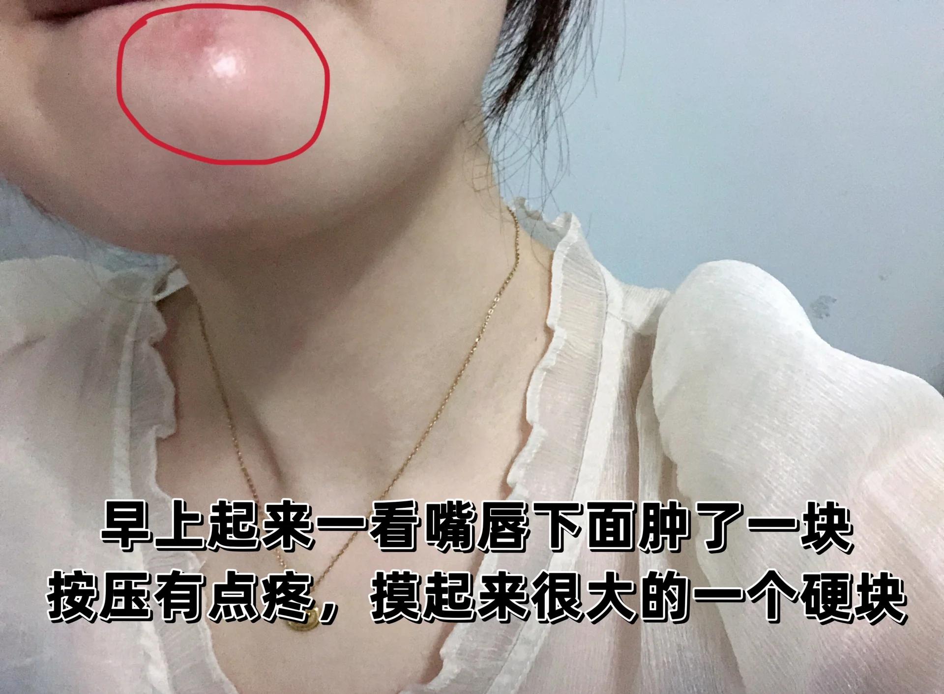 下巴富贵坑图片(下巴富贵坑的男性面相) 下巴富贵坑图片(下巴富贵坑的男性面相)