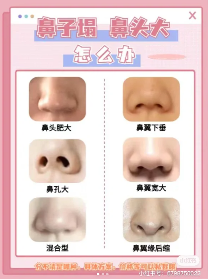 女人鼻子大鼻头肉多好不好的简单介绍 女人鼻子大鼻头肉多好不好的简单介绍