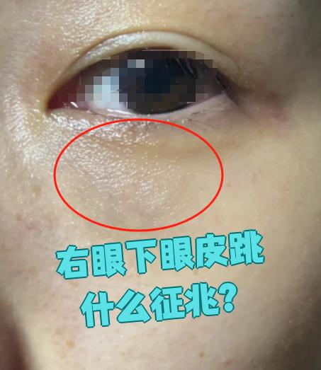 右下眼皮跳是什么预兆测吉凶(右下眼皮跳是什么预兆测吉凶 华易) 右下眼皮跳是什么预兆测吉凶(右下眼皮跳是什么预兆测吉凶 华易)