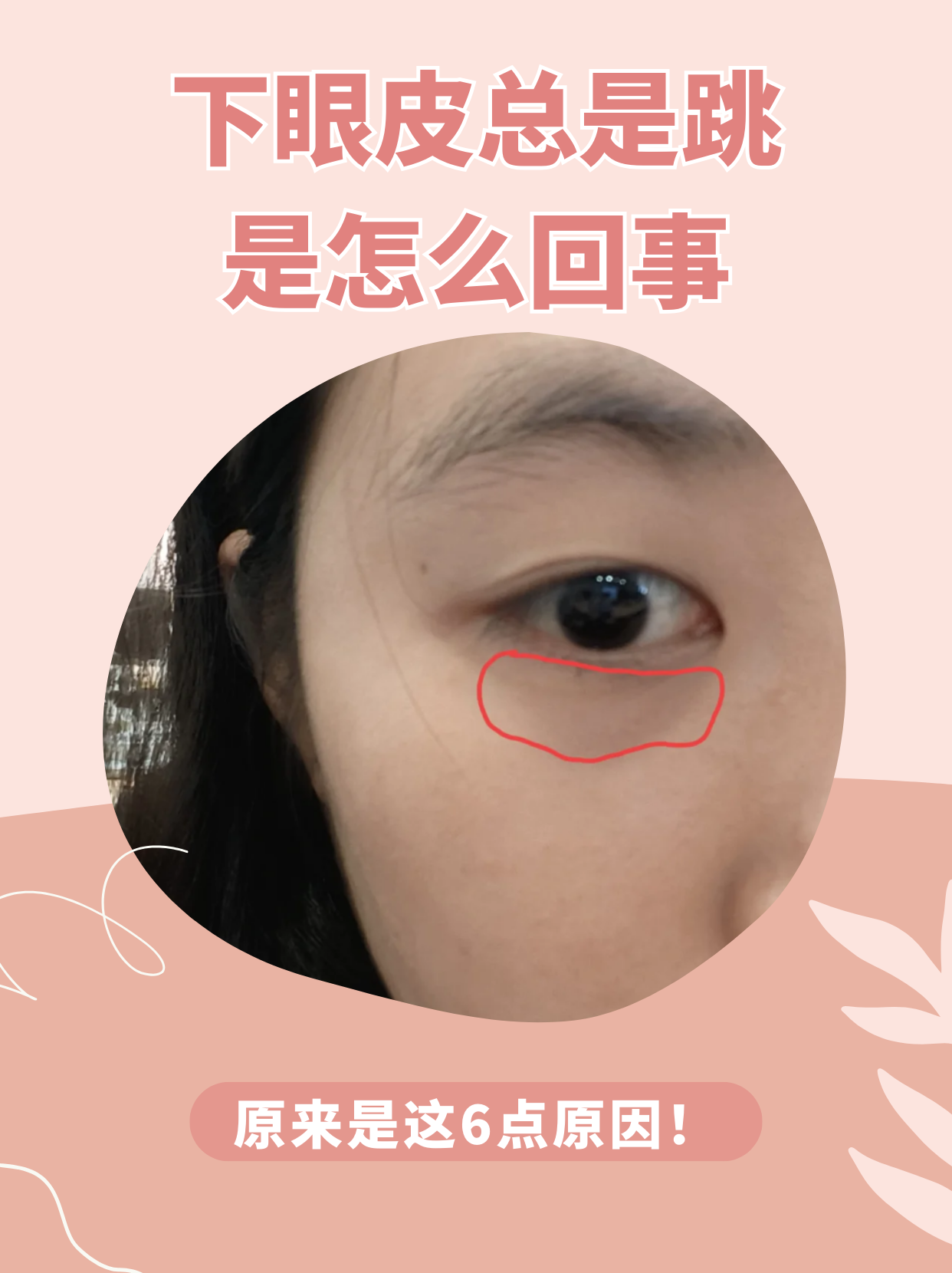 男人右下眼皮跳运势(男人右下眼皮跳是吉是凶) 男人右下眼皮跳运势(男人右下眼皮跳是吉是凶)