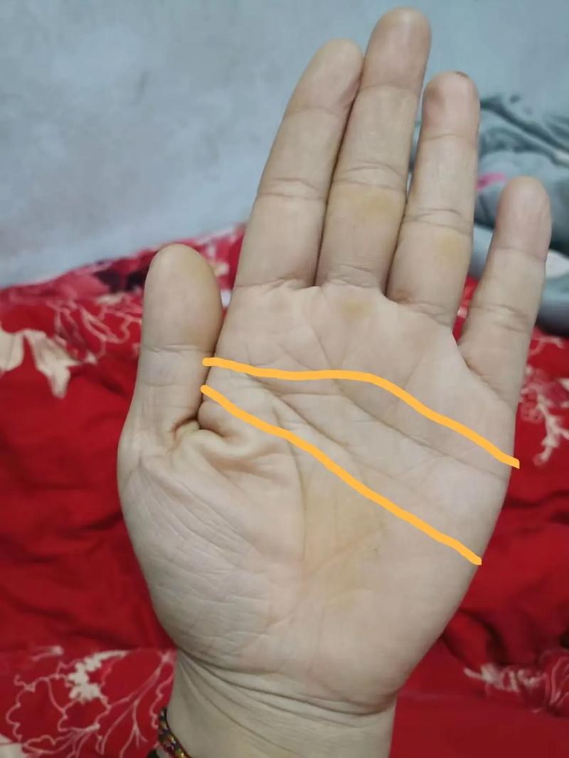为什么假断掌要比真断掌要好(为什么假断掌要比真断掌要好呢) 为什么假断掌要比真断掌要好(为什么假断掌要比真断掌要好呢)