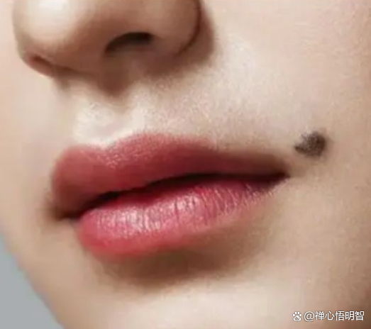 右嘴角有痣的女人(右嘴角有痣的女人能去掉吗) 右嘴角有痣的女人(右嘴角有痣的女人能去掉吗)