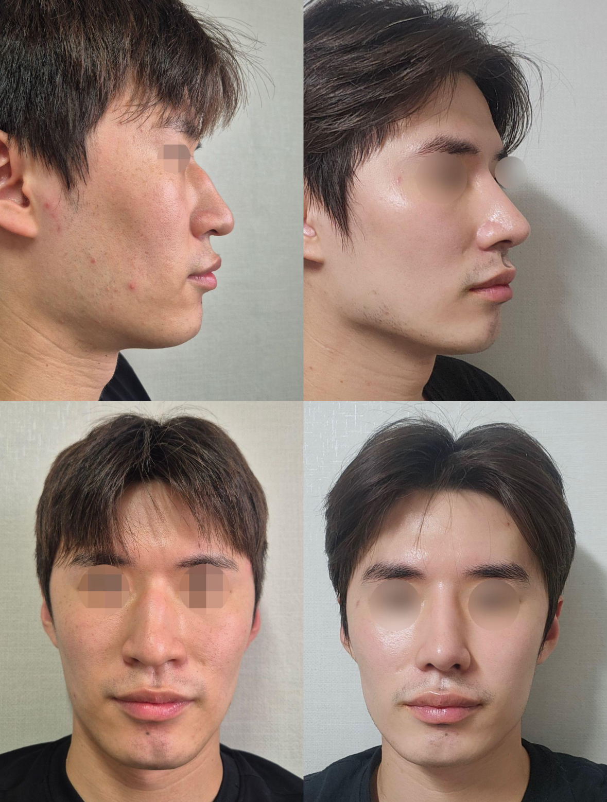 男人山根低鼻头大(男人山根低鼻头大的命运) 男人山根低鼻头大(男人山根低鼻头大的命运)