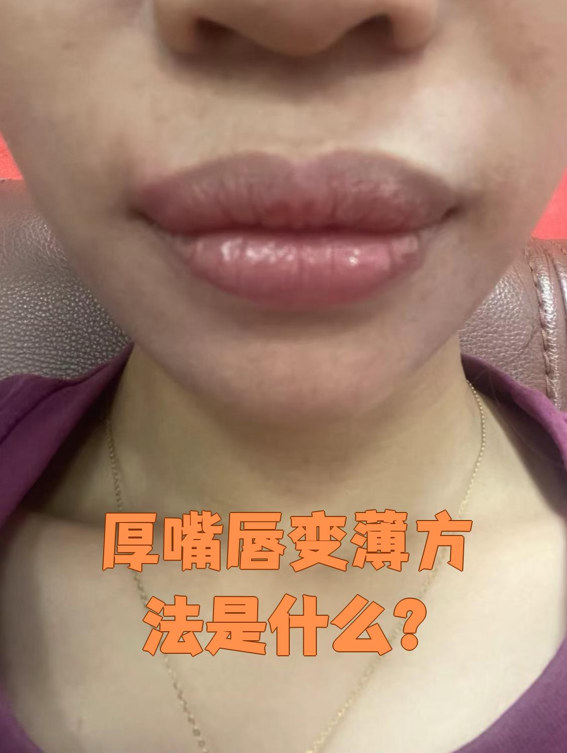 上唇厚下唇薄的男人(上唇厚下唇薄的男人命运) 上唇厚下唇薄的男人(上唇厚下唇薄的男人命运)