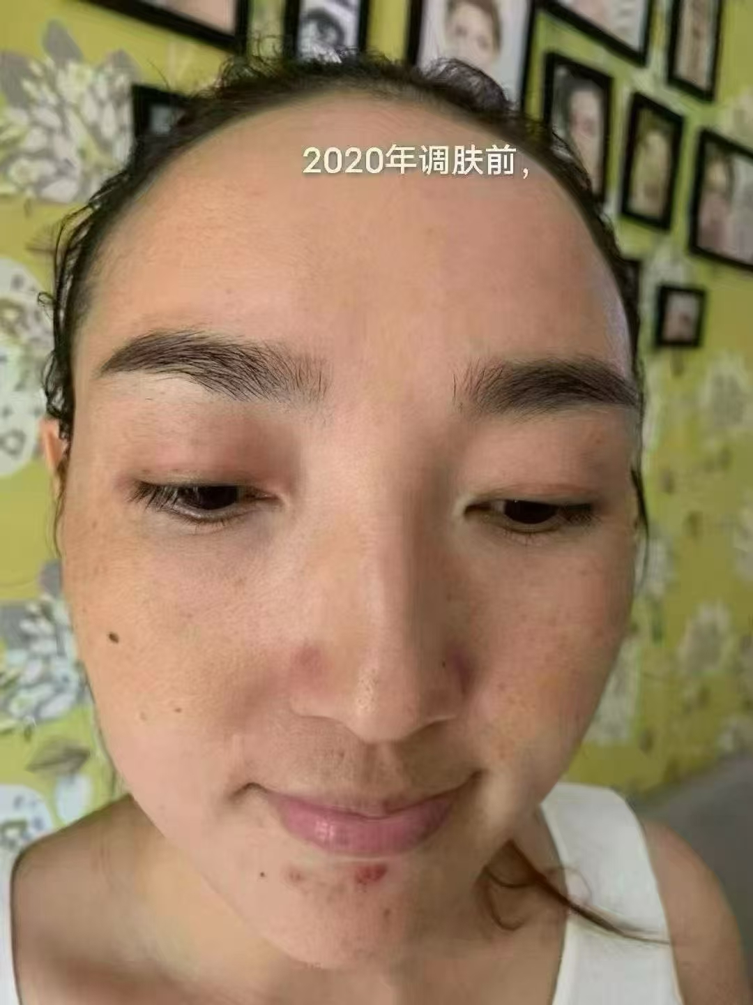 沙棘油涂脸上能祛斑(沙棘油擦脸可以美白吗) 沙棘油涂脸上能祛斑(沙棘油擦脸可以美白吗)