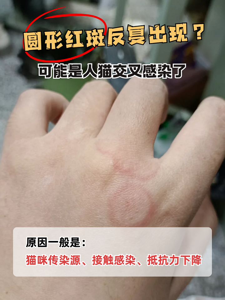 人猫共患4大传染病(猫人畜共患传染病有哪些) 人猫共患4大传染病(猫人畜共患传染病有哪些)