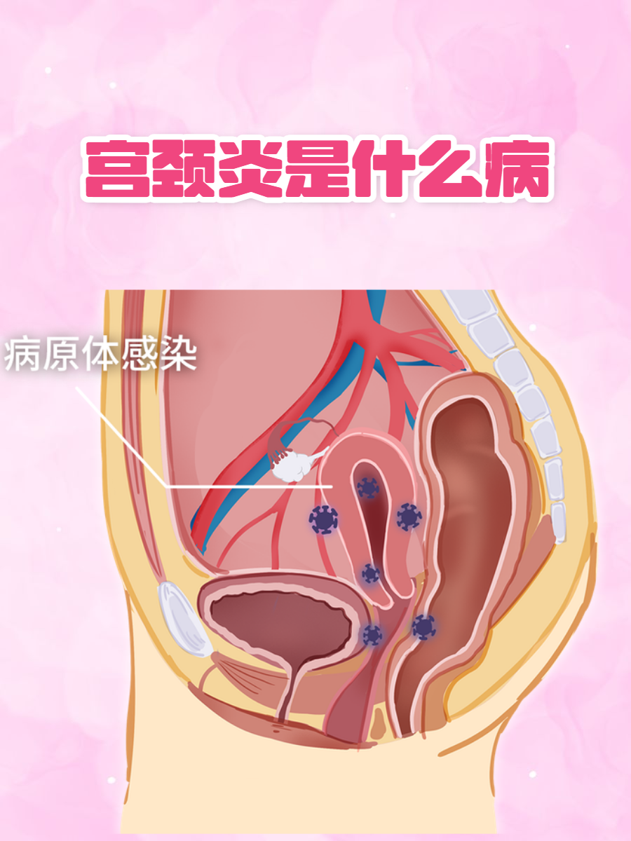 常见20种妇科病图片(常见20种妇科病图片及症状) 常见20种妇科病图片(常见20种妇科病图片及症状)