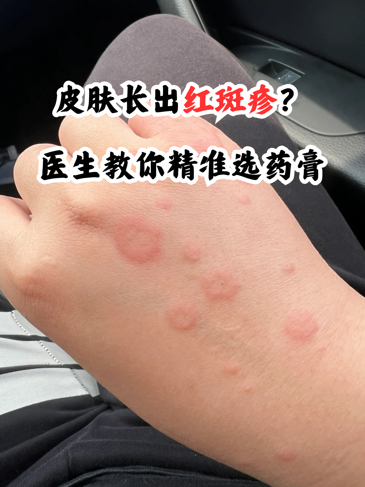 扫一扫识别皮肤病拍照(扫一扫识别皮肤病拍照微信) 扫一扫识别皮肤病拍照(扫一扫识别皮肤病拍照微信)