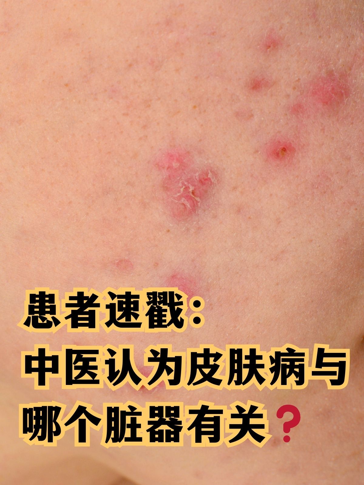 扫一扫识别皮肤病拍照(扫一扫识别皮肤病拍照微信) 扫一扫识别皮肤病拍照(扫一扫识别皮肤病拍照微信)