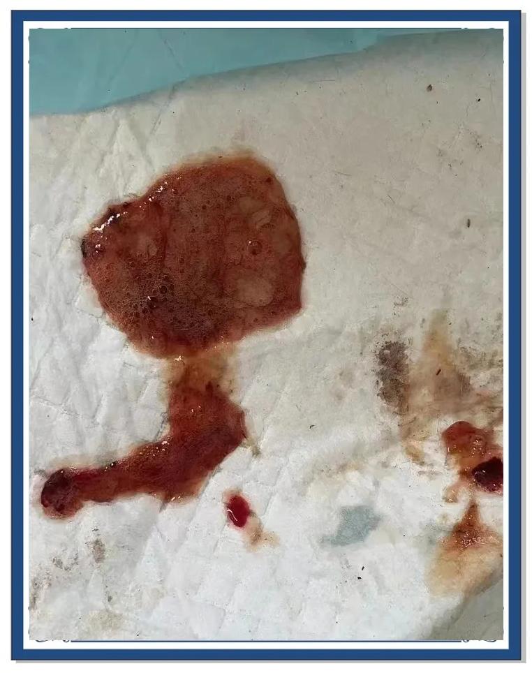 怎么判断狗狗有没有胰腺炎(怎么确诊狗狗是不是得了胰腺炎) 怎么判断狗狗有没有胰腺炎(怎么确诊狗狗是不是得了胰腺炎)