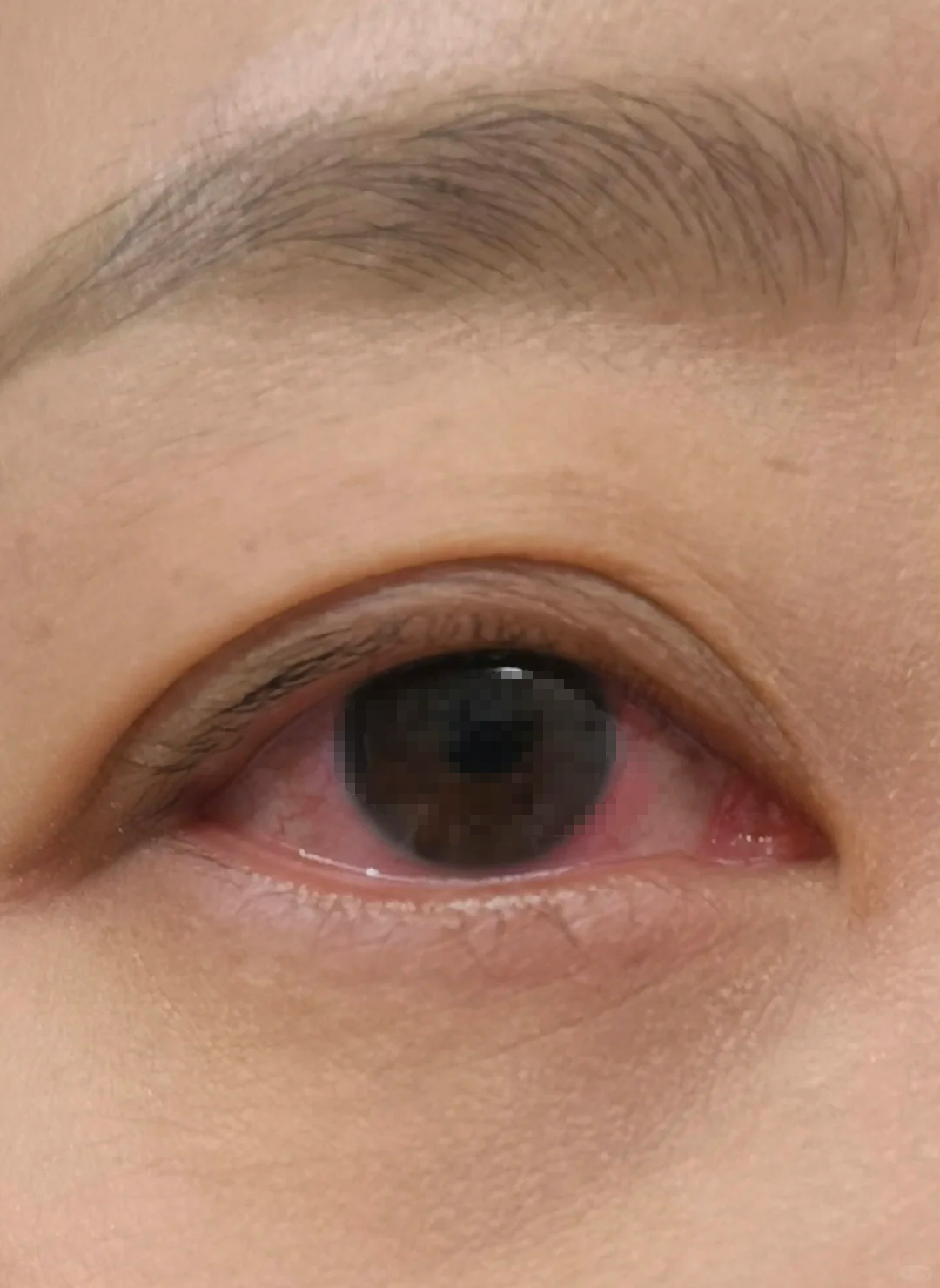 狗狗眼睛有红血丝(狗狗眼睛有红血丝像虫) 狗狗眼睛有红血丝(狗狗眼睛有红血丝像虫)