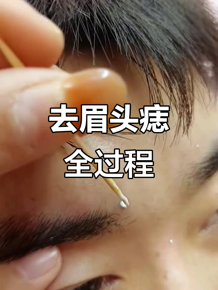 左眉**有疤是命太好了(左眉毛有道疤有什么说法吗)