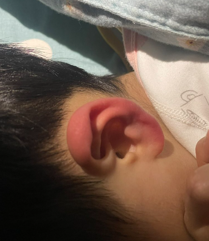 左耳发热是什么预兆男(左耳发热是什么预兆男性) 左耳发热是什么预兆男(左耳发热是什么预兆男性)