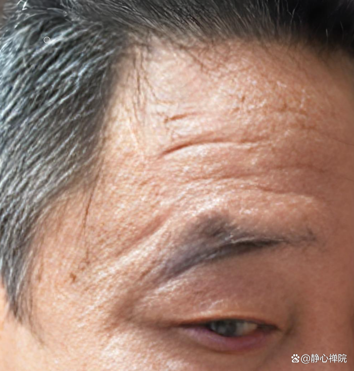 阴德厚重的女人面相(缺德纹和阴德纹图片对比) 阴德厚重的女人面相(缺德纹和阴德纹图片对比)