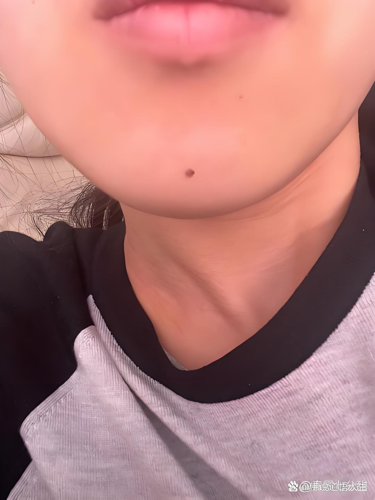 下巴痣千年积德(地库痣和下巴痣的不同) 下巴痣千年积德(地库痣和下巴痣的不同)