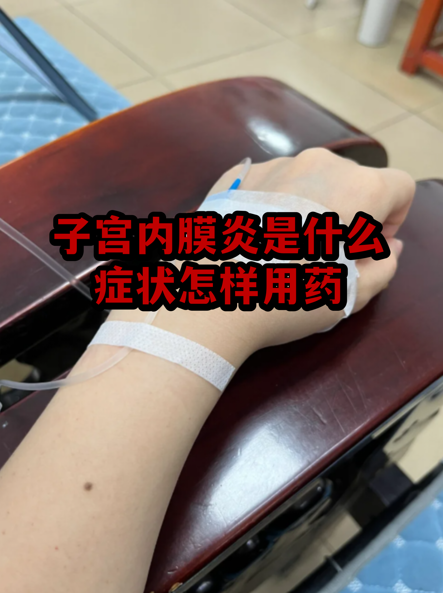 子宫内膜炎排出物图片(子宫内膜炎排出烂肉一样的东西)
