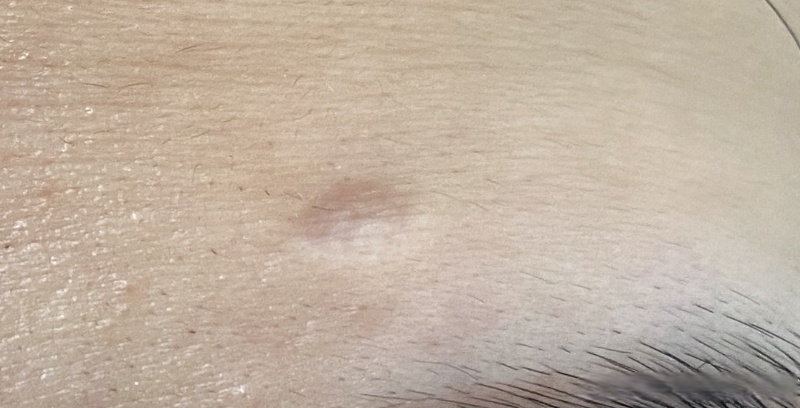 眉**有疤痕影响运势吗(眉毛有疤痕影响运势吗怎么破解) 眉**有疤痕影响运势吗(眉毛有疤痕影响运势吗怎么破解)