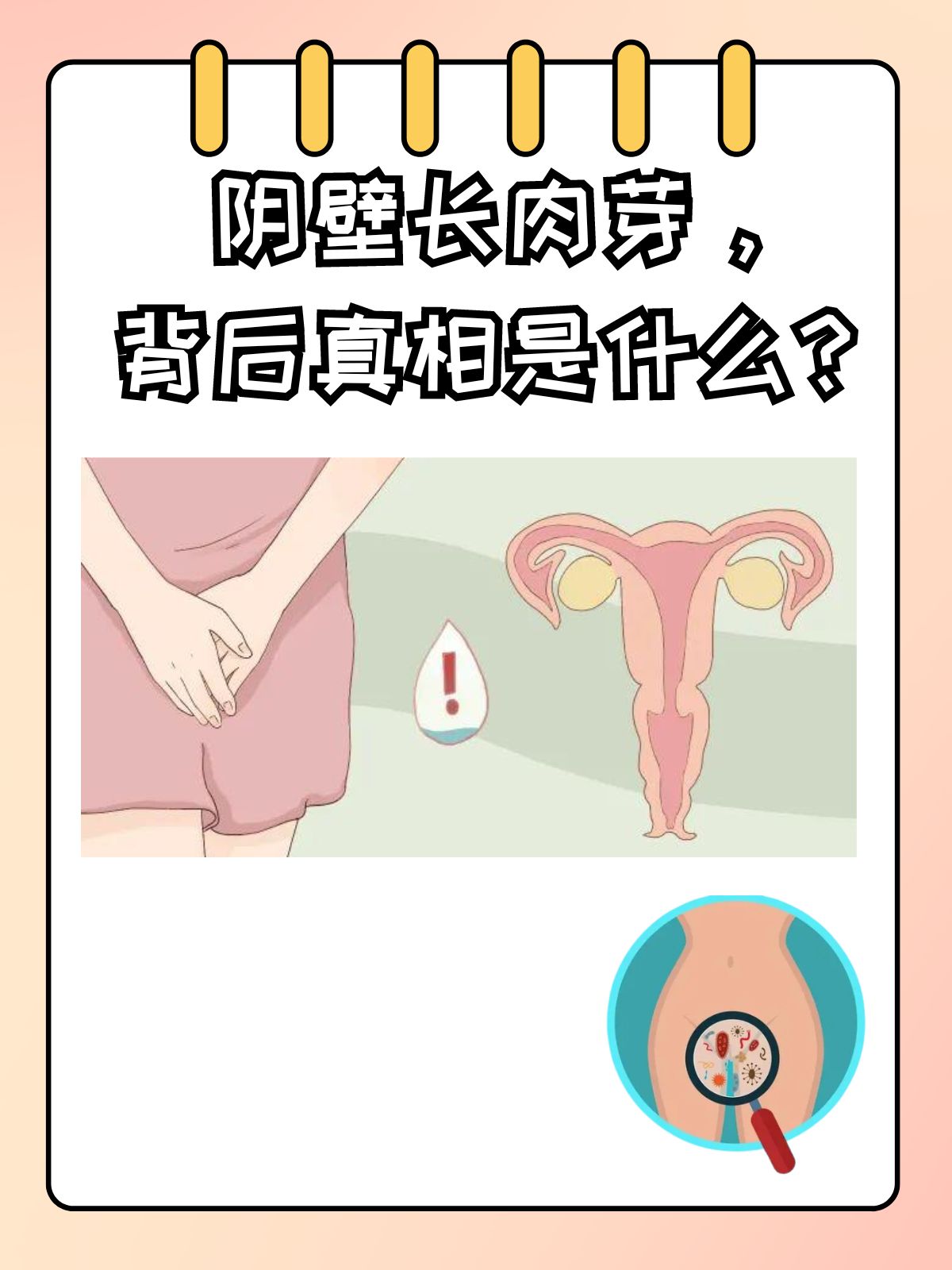 阴包阴是什么形态(阴包穴在什么位置?) 阴包阴是什么形态(阴包穴在什么位置?)