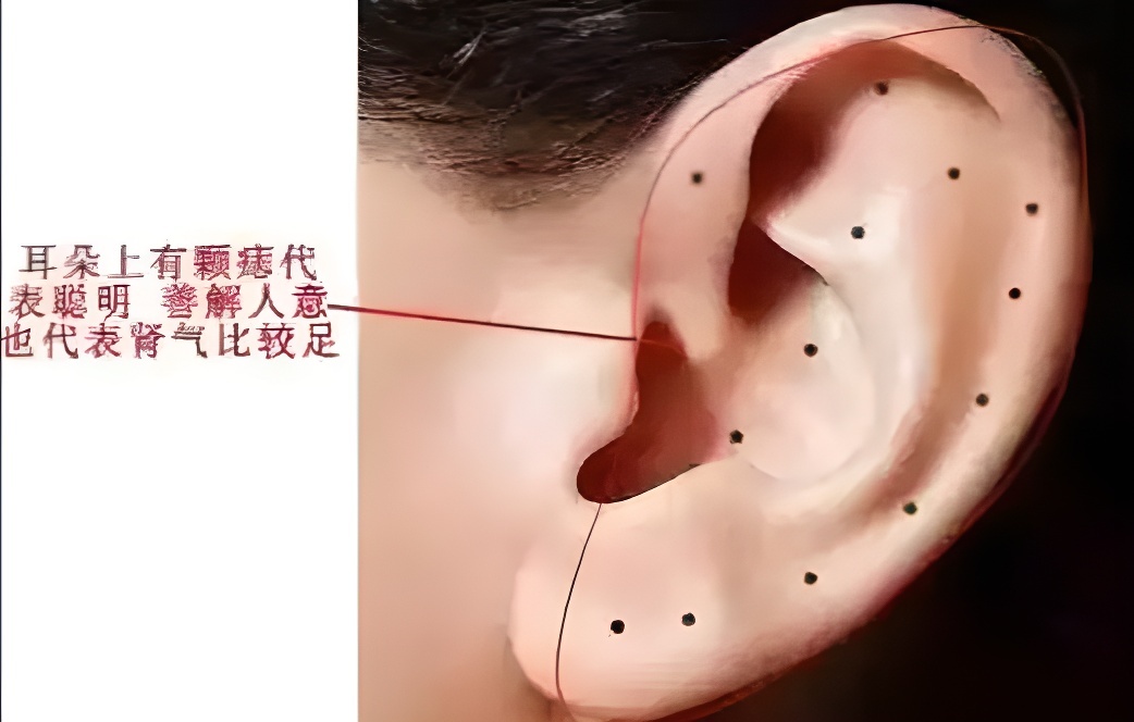 耳垂后面有痣代表什么(女人右耳垂后面有痣代表什么)